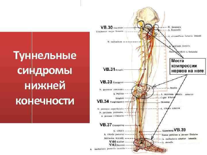 Туннельные синдромы нижней конечности 