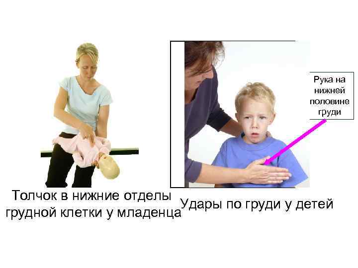 Рука на нижней половине груди Толчок в нижние отделы Удары по груди у детей