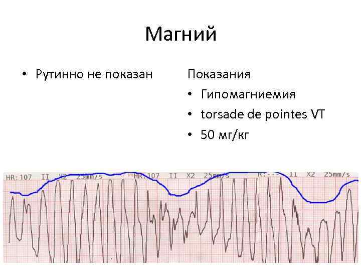 Магний • Рутинно не показан Показания • Гипомагниемия • torsade de pointes VT •