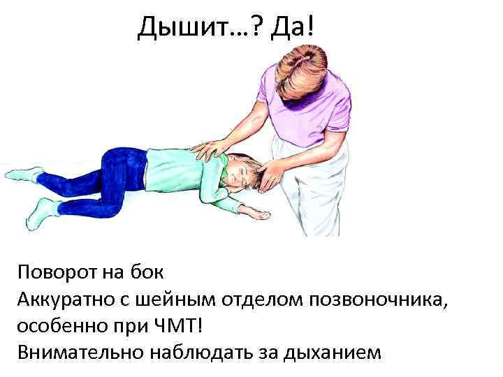 Дышит…? Да! Поворот на бок Аккуратно с шейным отделом позвоночника, особенно при ЧМТ! Внимательно