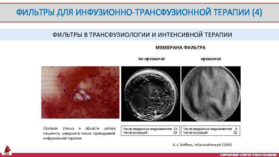 ФИЛЬТРЫ ДЛЯ ИНФУЗИОННО-ТРАНСФУЗИОННОЙ ТЕРАПИИ (4) ФИЛЬТРЫ В ТРАНСФУЗИОЛОГИИ И ИНТЕНСИВНОЙ ТЕРАПИИ МЕМБРАНА ФИЛЬТРА не