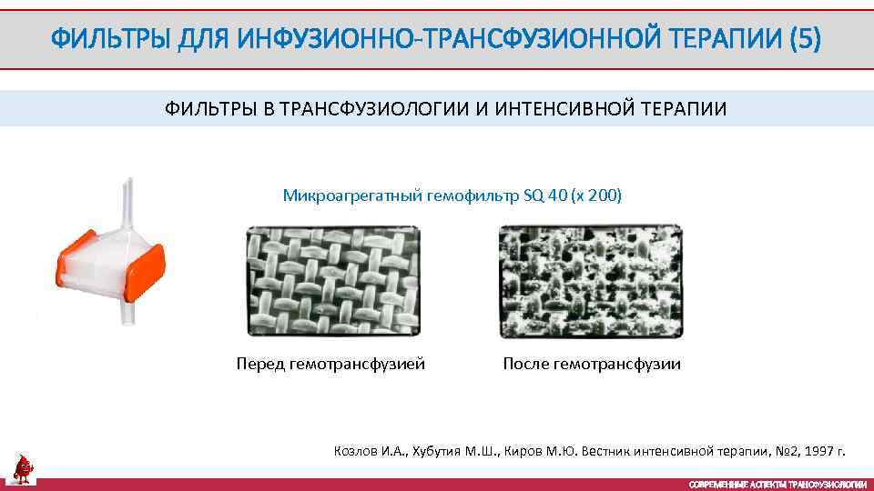 ФИЛЬТРЫ ДЛЯ ИНФУЗИОННО-ТРАНСФУЗИОННОЙ ТЕРАПИИ (5) ФИЛЬТРЫ В ТРАНСФУЗИОЛОГИИ И ИНТЕНСИВНОЙ ТЕРАПИИ Микроагрегатный гемофильтр SQ