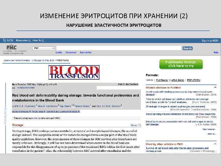 ИЗМЕНЕНИЕ ЭРИТРОЦИТОВ ПРИ ХРАНЕНИИ (2) НАРУШЕНИЕ ЭЛАСТИЧНОСТИ ЭРИТРОЦИТОВ 