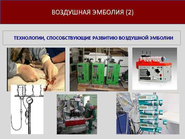 ВОЗДУШНАЯ ЭМБОЛИЯ (2) ТЕХНОЛОГИИ, СПОСОБСТВУЮЩИЕ РАЗВИТИЮ ВОЗДУШНОЙ ЭМБОЛИИ 