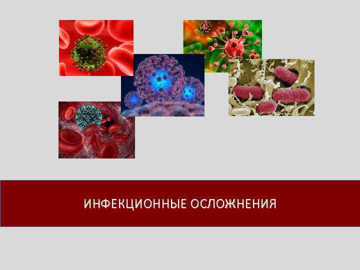 ИНФЕКЦИОННЫЕ ОСЛОЖНЕНИЯ 