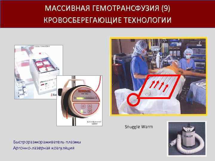 МАССИВНАЯ ГЕМОТРАНСФУЗИЯ (9) КРОВОСБЕРЕГАЮЩИЕ ТЕХНОЛОГИИ Snuggle Warm Быстроразмораживатель плазмы Аргонно лазерная коагуляция 