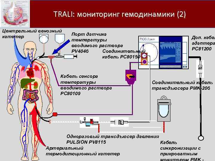  TRALI: мониторинг гемодинамики (2) Центральный венозный катетер Порт датчика температуры вводимого раствора Соединительный