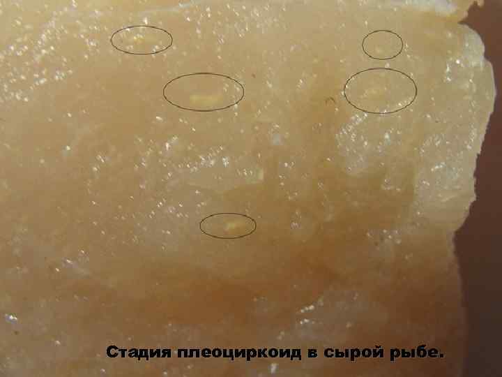 Стадия плеоциркоид в сырой рыбе. 