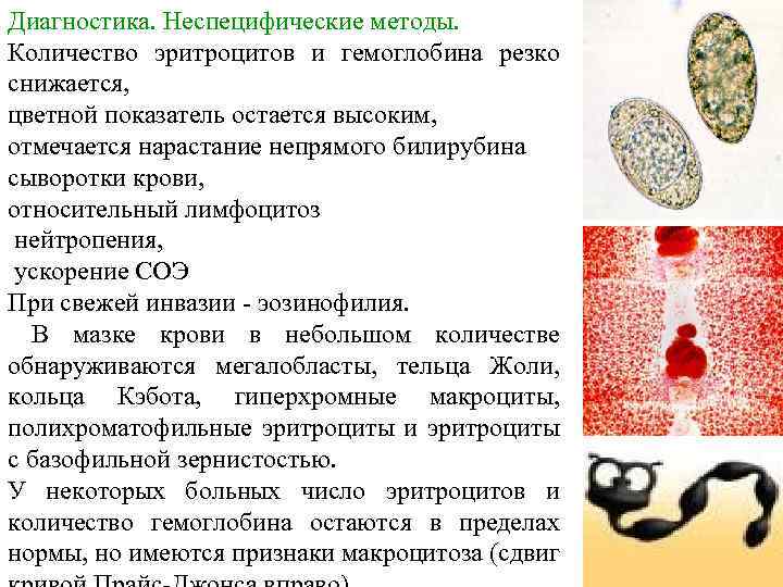 Диагностика. Неспецифические методы. Количество эритроцитов и гемоглобина резко снижается, цветной показатель остается высоким, отмечается