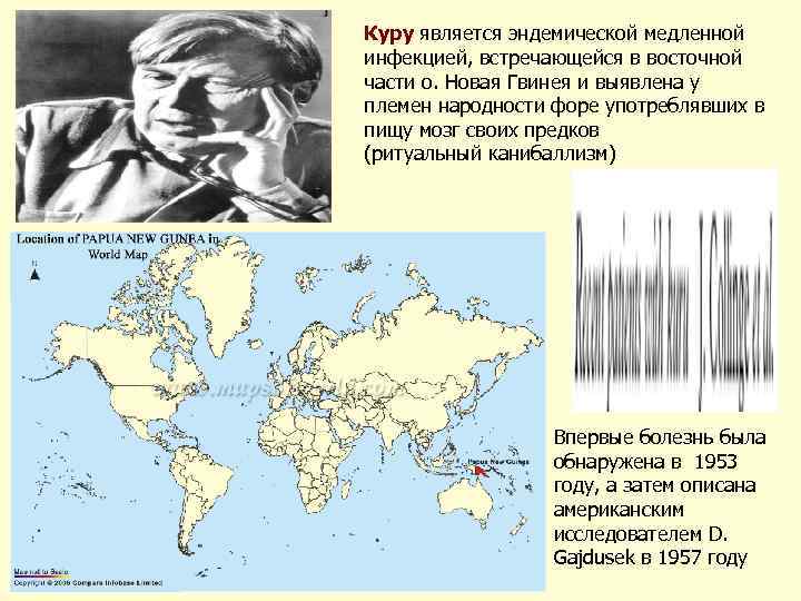 Куру является эндемической медленной инфекцией, встречающейся в восточной части о. Новая Гвинея и выявлена