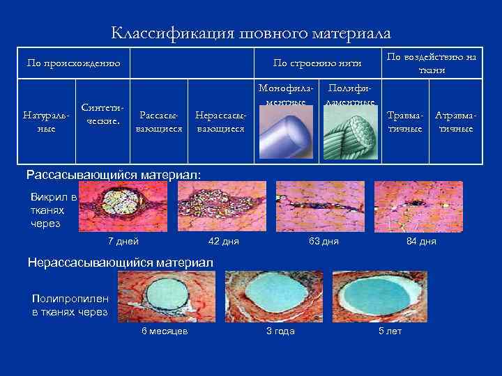 Классификация шовного материала По происхождению Натуральные Синтетические. По строению нити По воздействию на ткани