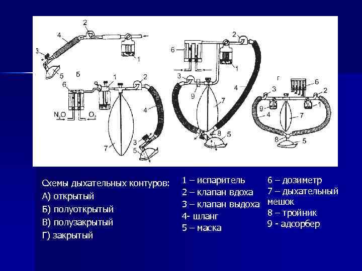 Схемы дыхательных контуров: А) открытый Б) полуоткрытый В) полузакрытый Г) закрытый 1 – испаритель