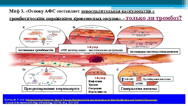Миф 3. «Основу АФС составляет невоспалительная васкулопатия с тромботическим поражением кровеносных сосудов» – только