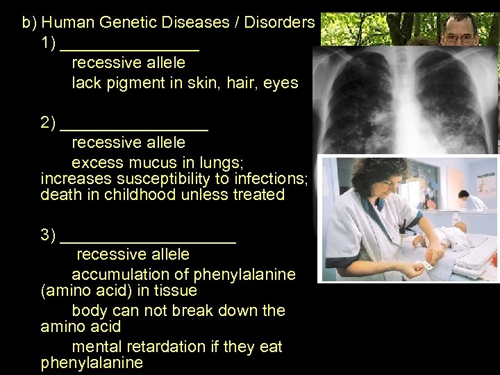 b) Human Genetic Diseases / Disorders 1) ________ recessive allele lack pigment in skin,