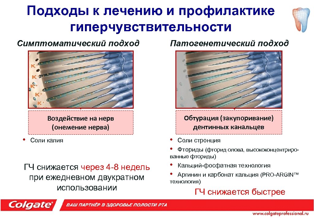 Подходы к лечению и профилактике гиперчувствительности Симптоматический подход Патогенетический подход Обтурация (закупоривание) дентинных канальцев