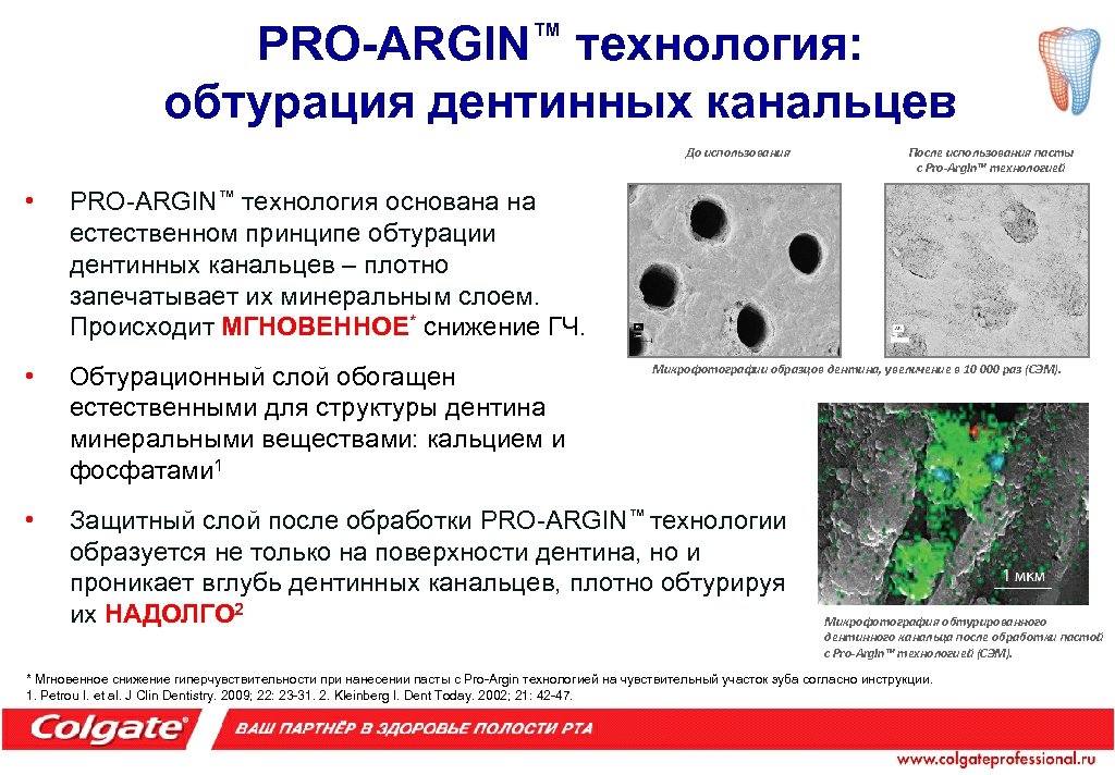PRO-ARGIN™ технология: обтурация дентинных канальцев До использования • PRO-ARGIN™ технология основана на естественном принципе