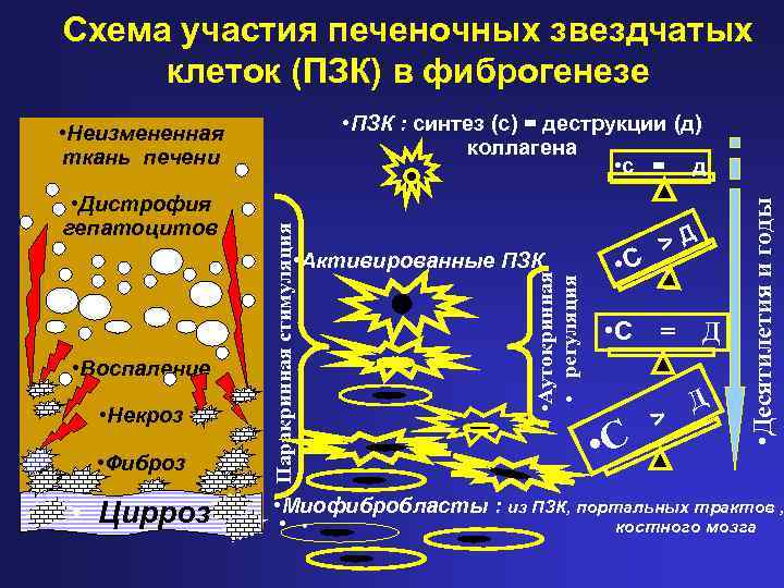 Схема участия печеночных звездчатых клеток (ПЗК) в фиброгенезе • Паракринная стимуляция • Дистрофия гепатоцитов