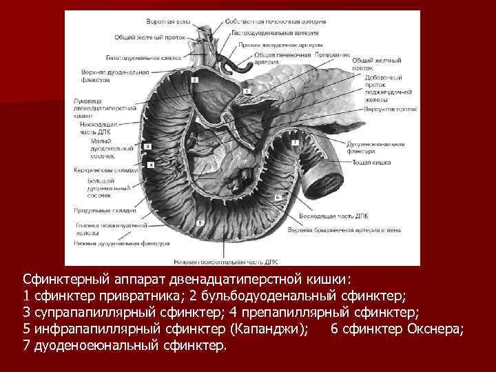 Сфинктерный аппарат двенадцатиперстной кишки: 1 сфинктер привратника; 2 бульбодуоденальный сфинктер; 3 супрапапиллярный сфинктер; 4