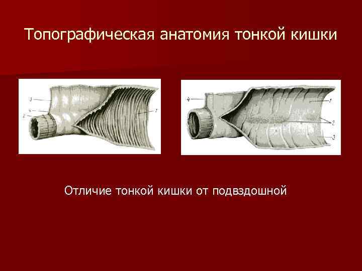 Топографическая анатомия тонкой кишки Отличие тонкой кишки от подвздошной 
