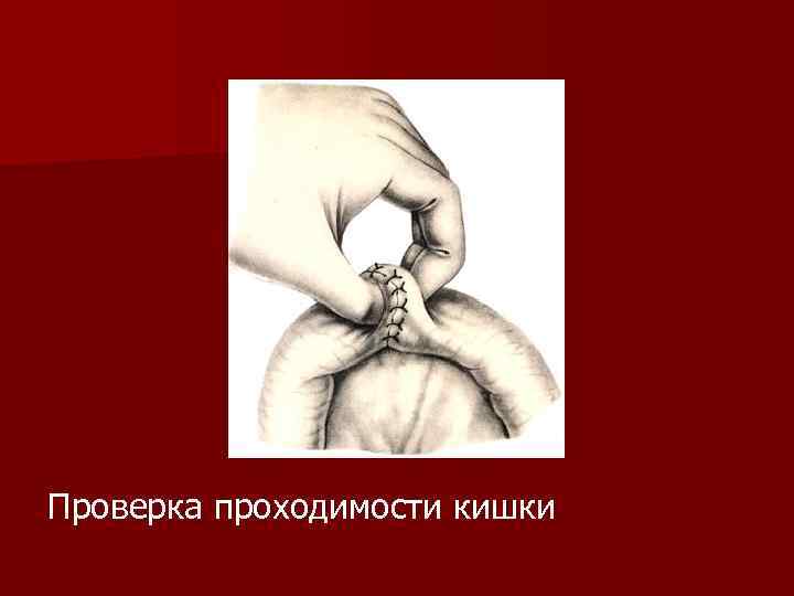 Проверка проходимости кишки 