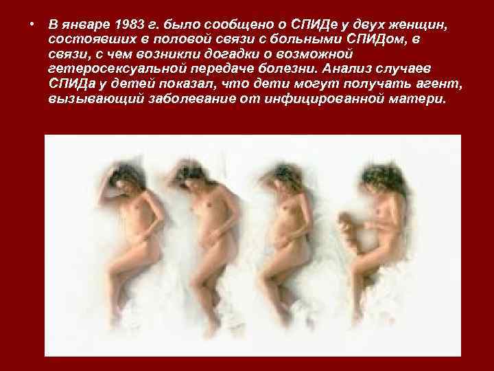  • В январе 1983 г. было сообщено о СПИДе у двух женщин, состоявших
