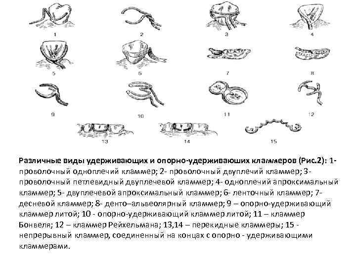 Классификация нея. Проволочный одноплечий кламмер. Петлевидный кламмер. Двуплечий проволочный удерживающий кламмер. Составные элементы опорно-удерживающего кламмера.