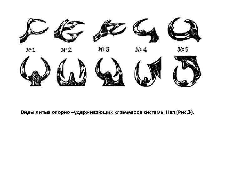 Виды литых опорно –удерживающих кламмеров системы Нея (Рис. 3). 