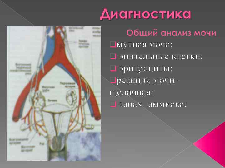 Диагностика Общий анализ мочи qмутная моча; q эпительные клетки; q эритроциты; qреакция мочи -