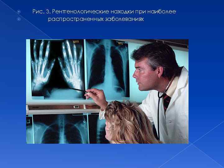  Рис. 3. Рентгенологические находки при наиболее распространенных заболеваниях 