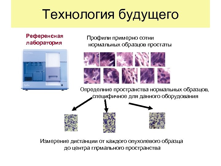 Технология будущего Референсная лаборатория Профили примерно сотни нормальных образцов простаты Определние пространства нормальных образцов,