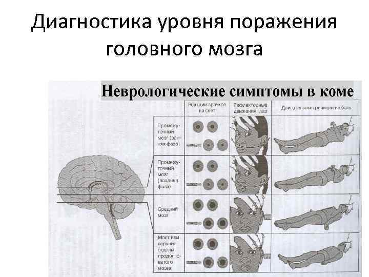 Диагностика уровня поражения головного мозга 