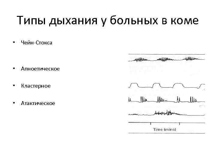 Типы дыхания у больных в коме • Чейн-Стокса • Апноетическое • Кластерное • Атактическое