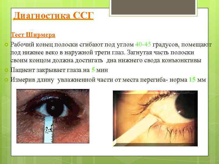  Диагностика ССГ Тест Ширмера Рабочий конец полоски сгибают под углом 40 -45 градусов,