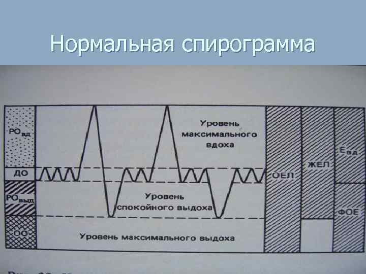 Нормальная спирограмма 