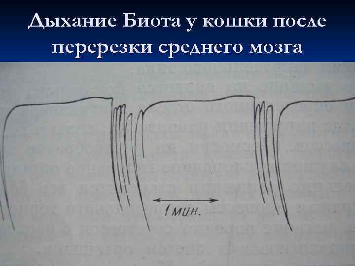 Дыхание Биота у кошки после перерезки среднего мозга 
