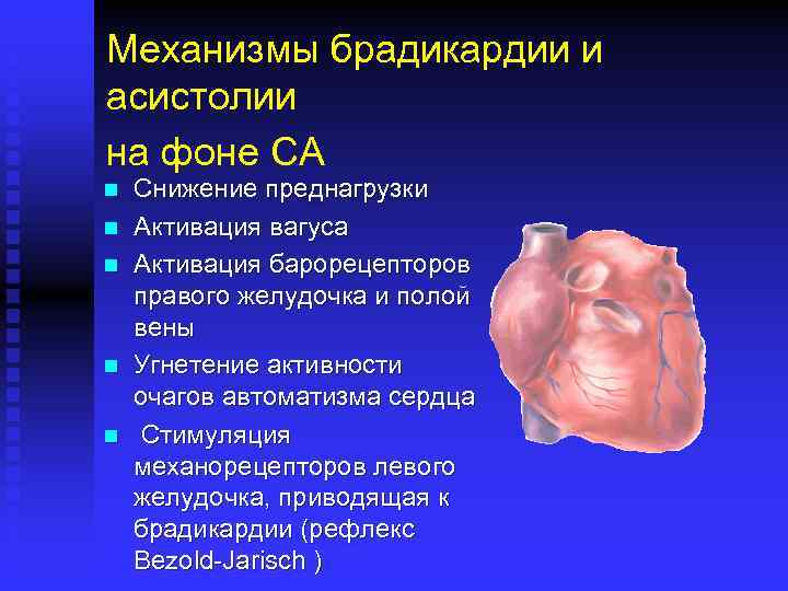 Механизмы брадикардии и асистолии на фоне СА n n n Снижение преднагрузки Активация вагуса