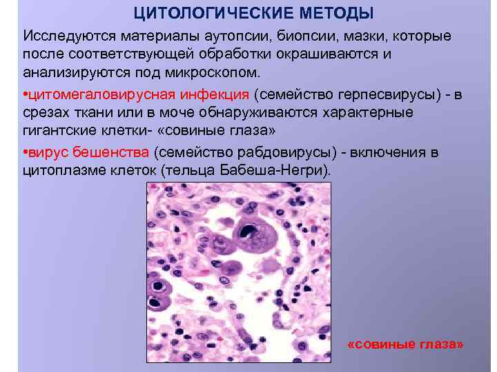 ЦИТОЛОГИЧЕСКИЕ МЕТОДЫ Исследуются материалы аутопсии, биопсии, мазки, которые после соответствующей обработки окрашиваются и анализируются