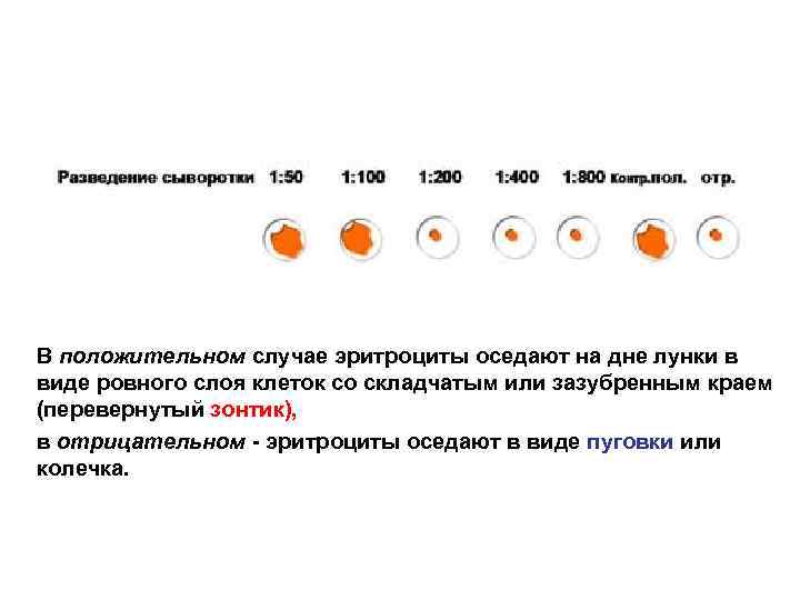 В положительном случае эритроциты оседают на дне лунки в виде ровного слоя клеток со