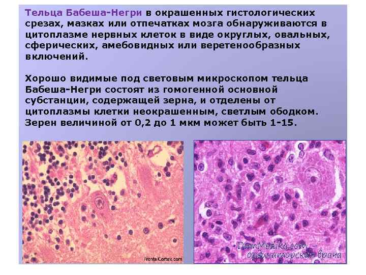 Тельца Бабеша-Негри в окрашенных гистологических срезах, мазках или отпечатках мозга обнаруживаются в цитоплазме нервных