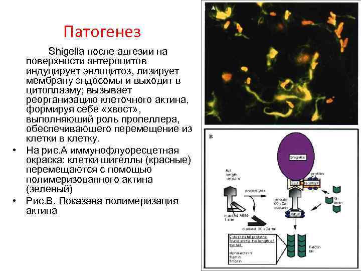 Патогенез Shigella после адгезии на поверхности энтероцитов индуцирует эндоцитоз, лизирует мембрану эндосомы и выходит