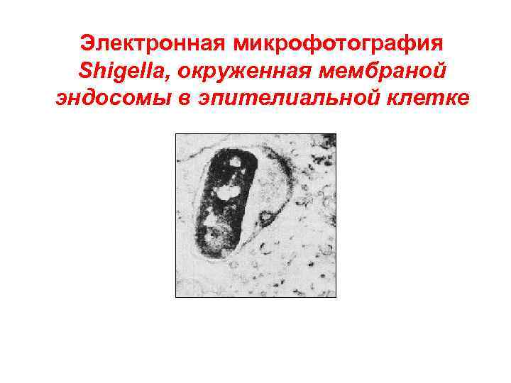 Электронная микрофотография Shigella, окруженная мембраной эндосомы в эпителиальной клетке 