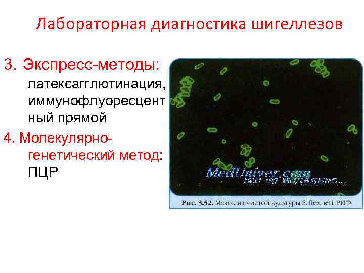 Лабораторная диагностика шигеллезов 3. Экспресс-методы: латексагглютинация, иммунофлуоресцент ный прямой 4. Молекулярногенетический метод: ПЦР 