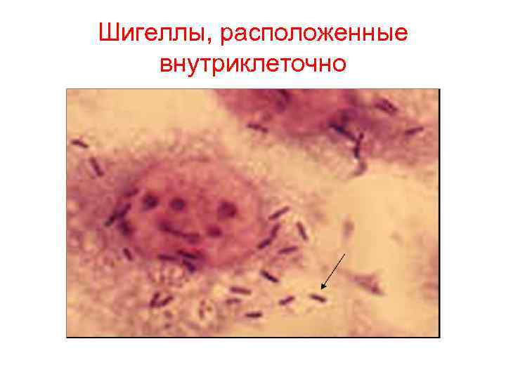 Шигеллы, расположенные внутриклеточно 