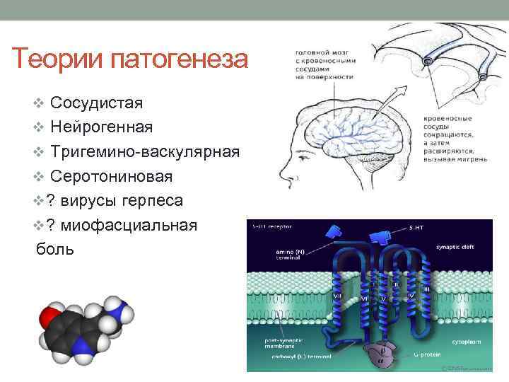 Теории патогенеза v Сосудистая v Нейрогенная v Тригемино-васкулярная v Серотониновая v ? вирусы герпеса