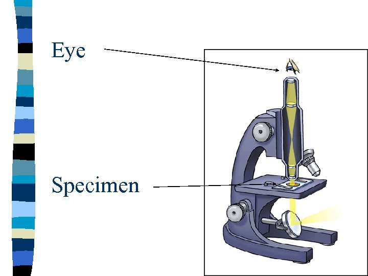 Eye Specimen 