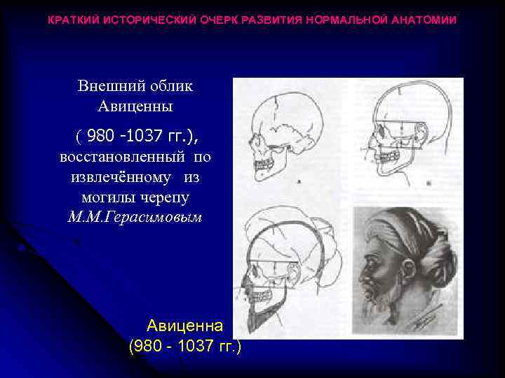 КРАТКИЙ ИСТОРИЧЕСКИЙ ОЧЕРК РАЗВИТИЯ НОРМАЛЬНОЙ АНАТОМИИ Внешний облик Авиценны ( 980 -1037 гг. ),