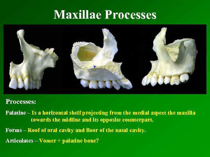 Maxillae Processes: Palatine – Is a horizontal shelf projecting from the medial aspect the