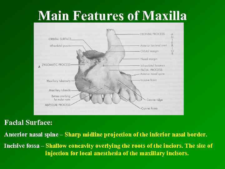 Main Features of Maxilla Facial Surface: Anterior nasal spine – Sharp midline projection of