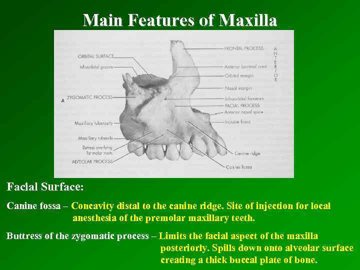 Main Features of Maxilla Facial Surface: Canine fossa – Concavity distal to the canine