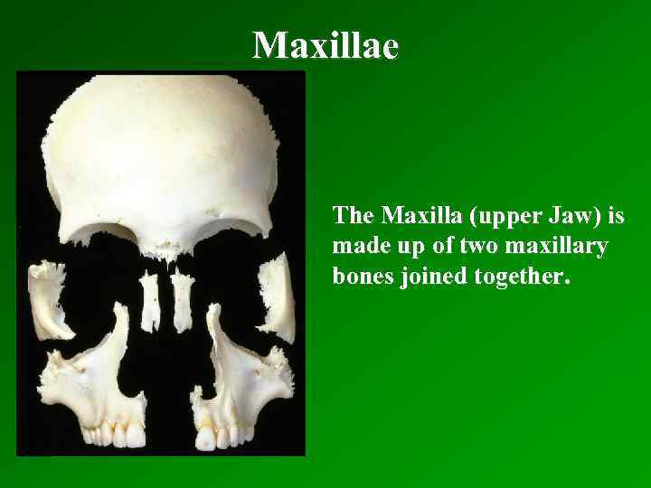 Maxillae The Maxilla (upper Jaw) is made up of two maxillary bones joined together.